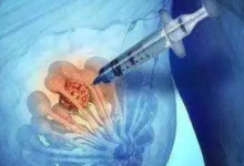 全球主要研究揭示了乳腺癌擴散到身體其他部位的風(fēng)險